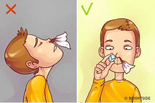 Có thể chườm đá hay đặt khăn mát lên vùng gốc mũi và má của trẻ giúp mạch máu ở mũi co lại, làm chậm quá trình chảy máu.