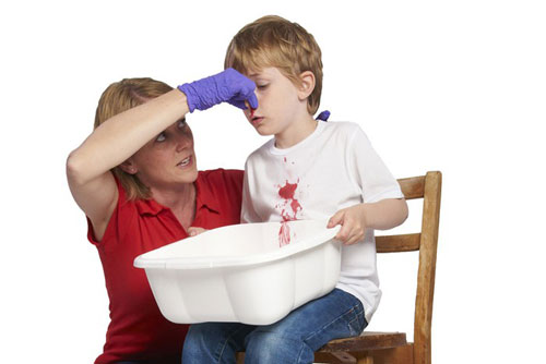 Yêu cầu trẻ xì mũi nhẹ nhàng để loại bỏ các cục máu đông đã hình thành bên trong mũi (Ảnh minh họa).